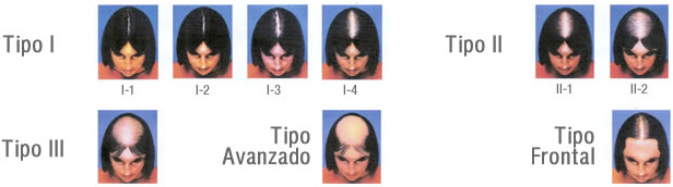 Figura2