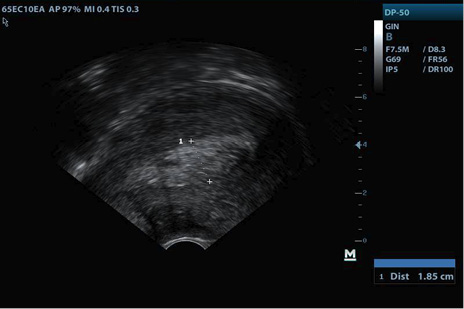D:\BAYRON_2\Documents\BAYRON\Publicaciones\RETENCION DE RESTOS\FOTOS\BADILLO_ALVAREZ45527379\GYN20181227115419\201812271159040001GYN.JPG