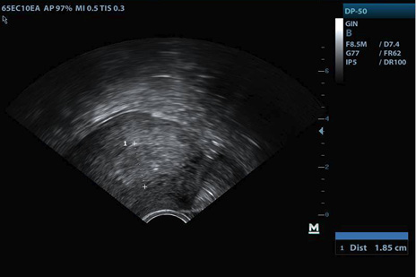 D:\BAYRON_2\Documents\BAYRON\Publicaciones\RETENCION DE RESTOS\FOTOS\BADILLO_ALVAREZ45527379\GYN20190124181519\201901241817340005GYN.JPG