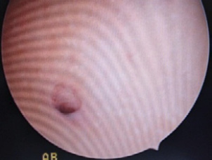 D:\BAYRON_2\Documents\BAYRON\FOTOS HISTEROSCOPIAS\KRB 2.jpg