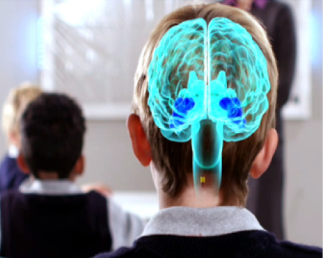 Implante%20cerebral.jpg