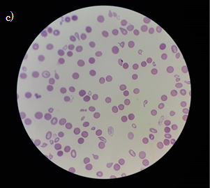 Figura1c