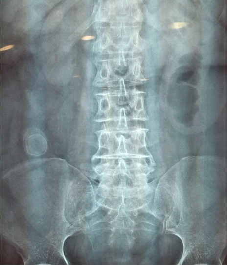 Imagen128942.JPG